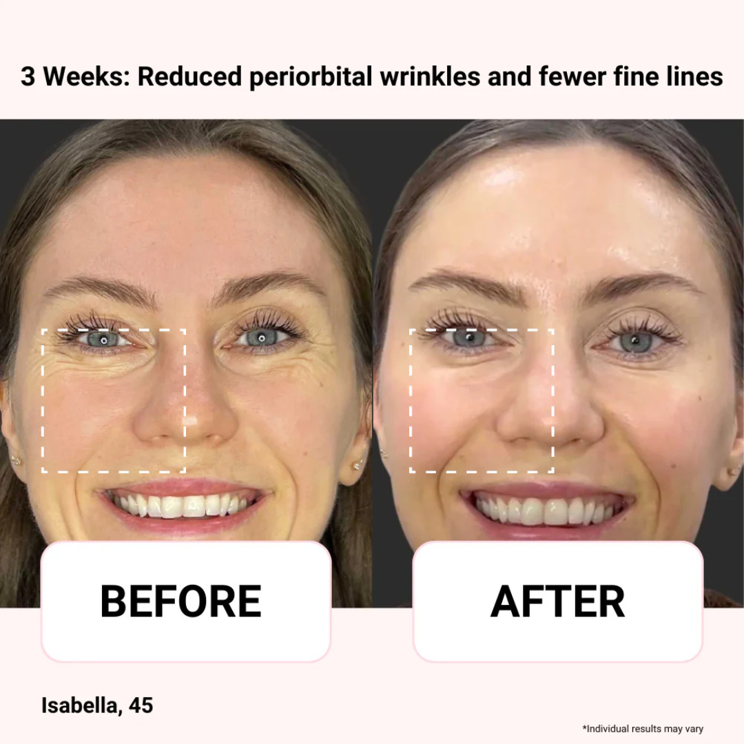 Odeiun™ Vegan Collagen Firming Eye Serum | Luxurious Anti-Aging Care from Korea