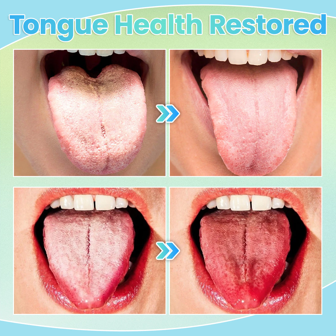ODEIUN™ GlosShield Tongue Repair Spray – 🌿 Heal & Revitalize Your Tongue for a Fresh Breath and Smooth Feel! 🦷💧