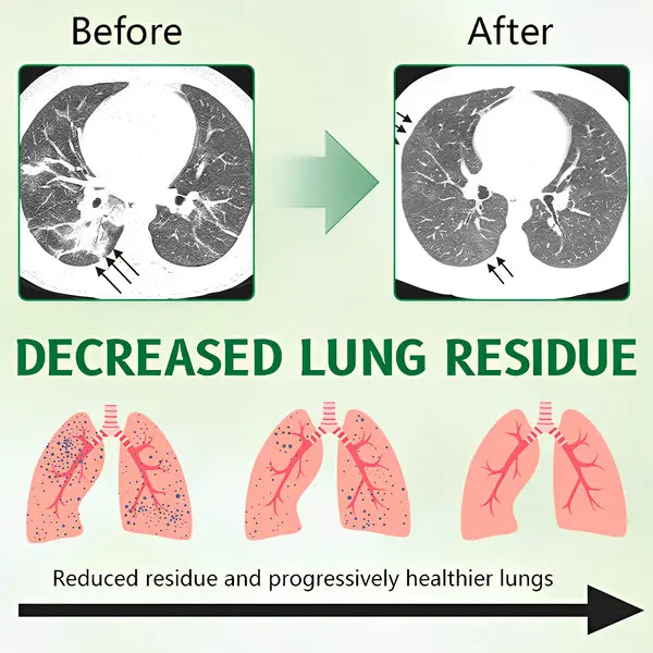 🌿 ODEIUN® 3X Mullein Lung Spray — Flush Out "Tar & Phlegm" for Smokers & COPD