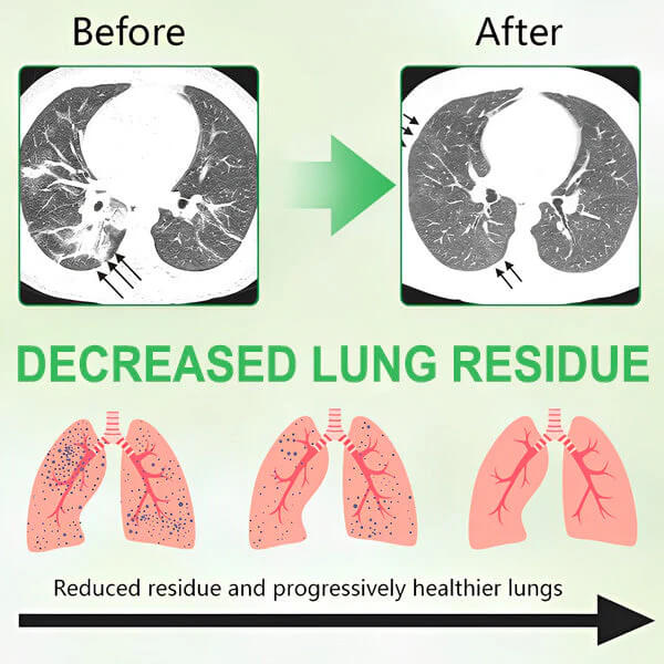 🌿 ODEIUN® 3X Concentrated Mullein Lung Cleanse Spray — Advanced Respiratory Detox & Clear Breathing