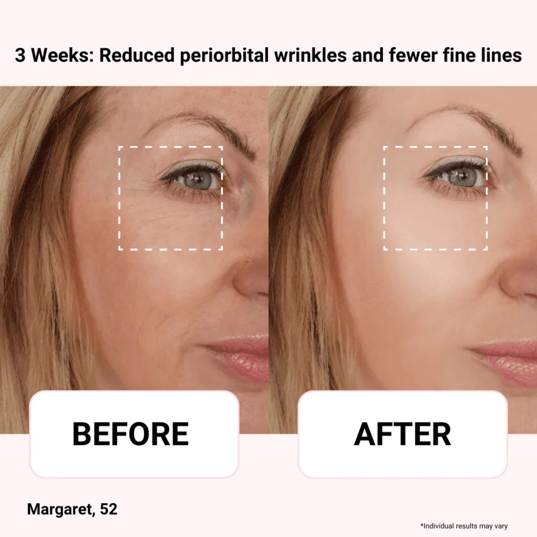 Odeiun™ Vegan Collagen Firming Eye Serum | Luxurious Anti-Aging Care from Korea