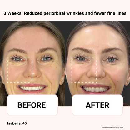 Odeiun™ Vegan Collagen Firming Eye Serum | Luxurious Anti-Aging Care from Korea