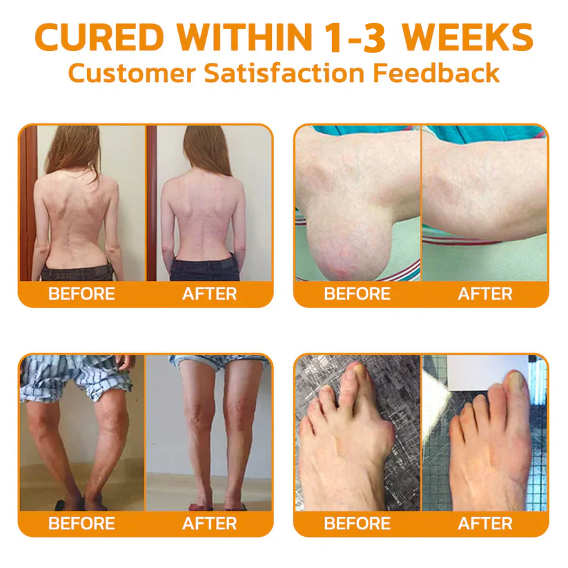 🐝 ODEIUN™ Magnesium & Bee Venom Joint Spray | Relieve Stiffness & Pain in 4 Weeks — No Rebound, Just Results 💪