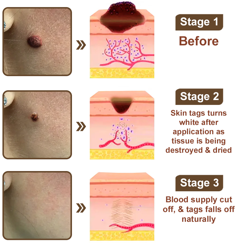 Seurico™ Black Rice Skin Repair Cream ⚕️ FDA Certified – Targets Warts, Psoriasis & Pigmentation