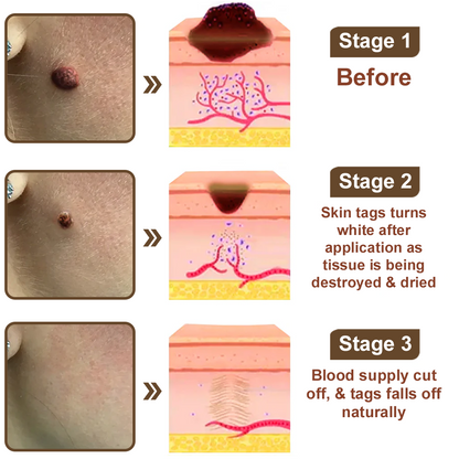 Seurico™ Black Rice Skin Repair Cream ⚕️ FDA Certified – Targets Warts, Psoriasis & Pigmentation