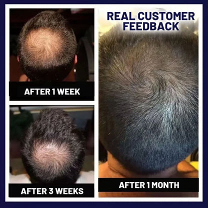 🌿 Odeiun™ Natural Hair Regrowth Spray – Naturally regrow fuller hair and restore your confidence