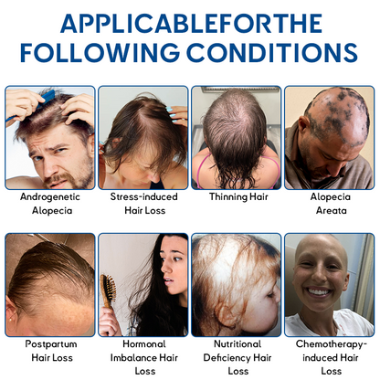 ✅Official Store: ODEIUN™ Advanced Stem Cell Hair Revival Roller 🌿💡 – Natural Formula, Visible Results in 7 Days(🔥UP TO 80% OFF)