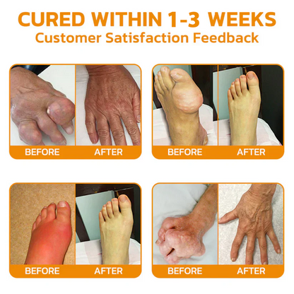 🐝 ODEIUN™ Magnesium & Bee Venom Joint Spray | Relieve Stiffness & Pain in 4 Weeks — No Rebound, Just Results 💪