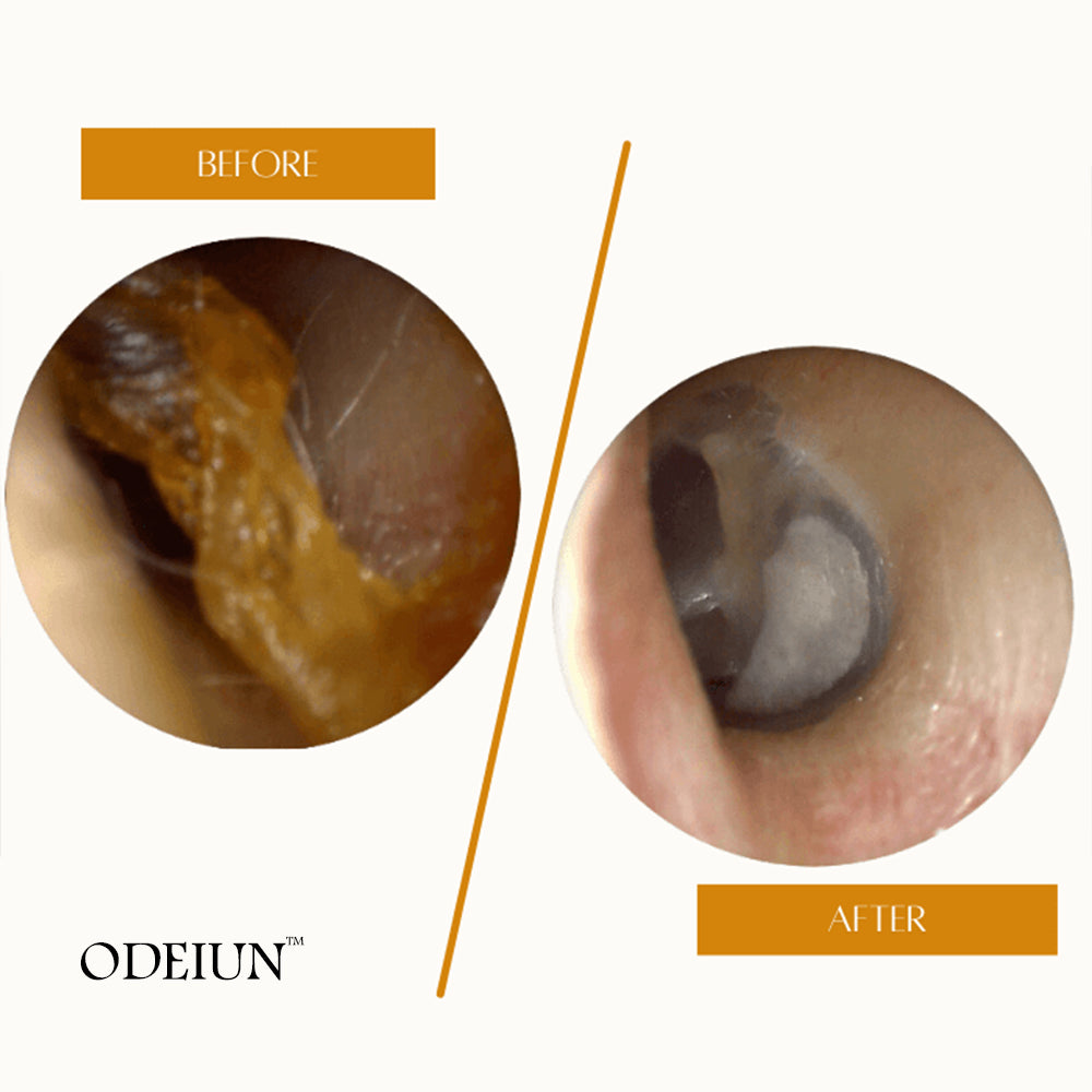 Odeiun™ Pro-Grade Ear Wax Removal Solution