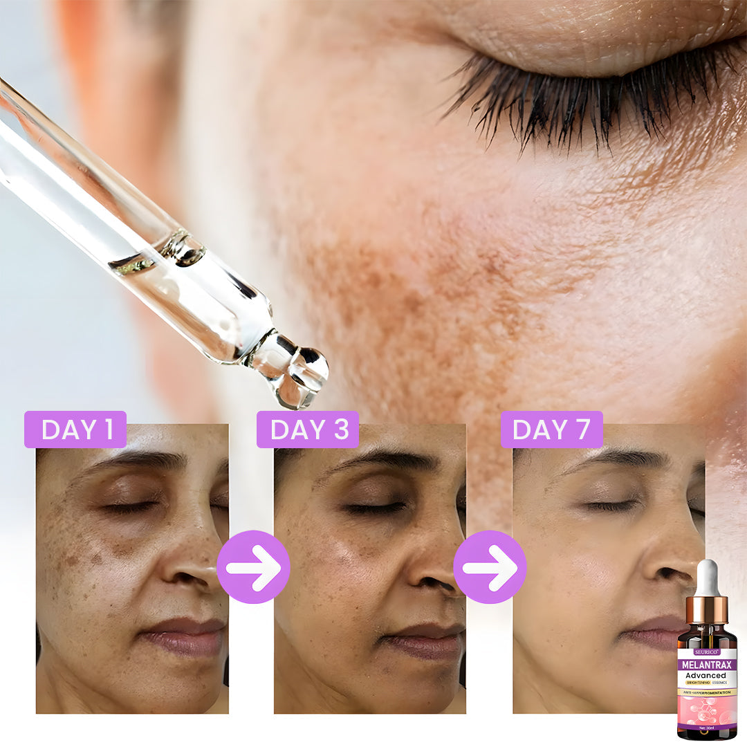 Seurico™ MelantraX Advanced Brightening Essence ACE – Radiant, Even-Tone Glow ✨💧