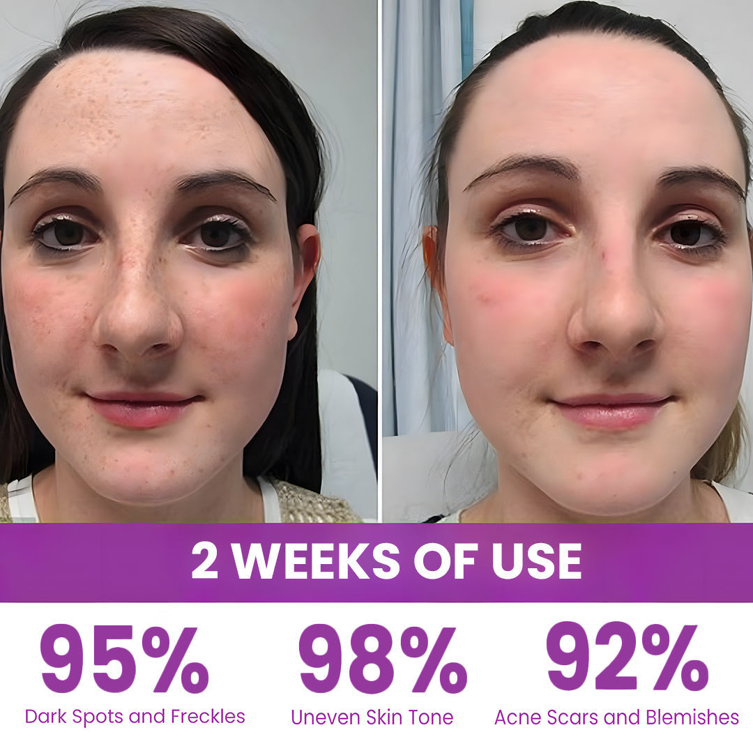 Seurico™ MelantraX Advanced Brightening Essence ACE – Radiant, Even-Tone Glow ✨💧