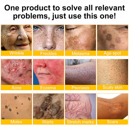 ✨ ODEIUN™ Bee Venom Skin Restoration Cream - Revitalize & Renew Your Skin Naturally! 🌿🐝