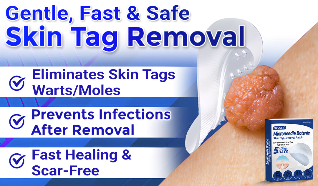 ✅Negusy™ MicroNeedle Botanic Skin Tag Removal Patches – 🇺🇸 Made in the USA | Fast, Painless, Plant-Powered