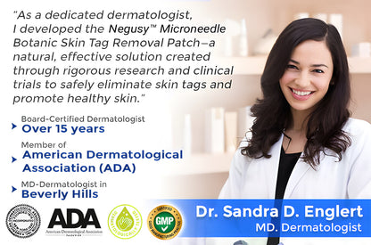 ✅Negusy™ MicroNeedle Botanic Skin Tag Removal Patches – 🇺🇸 Made in the USA | Fast, Painless, Plant-Powered