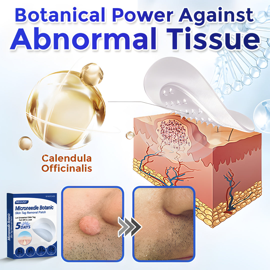 ✅Negusy™ MicroNeedle Botanic Skin Tag Removal Patches – 🇺🇸 Made in the USA | Fast, Painless, Plant-Powered
