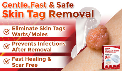 Negusy™ MicroNeedle Botanic Skin Tag Removal Patches – 🇺🇸 Made in the USA | Fast, Painless, Plant-Powered