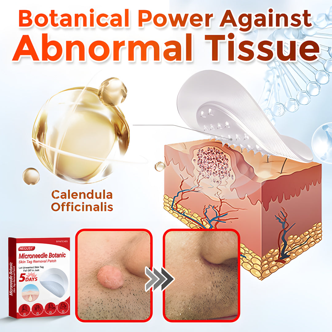 Negusy™ MicroNeedle Botanic Skin Tag Removal Patches – 🇺🇸 Made in the USA | Fast, Painless, Plant-Powered
