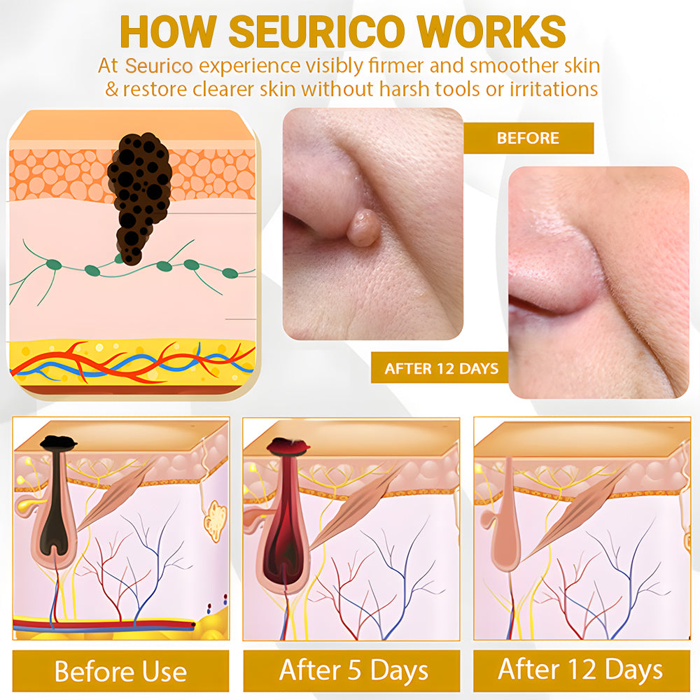 【🔥Last Day Promotion 45% OFF⚡】Seurico™ CastorBee Tag & Spots Peel-Off Mask