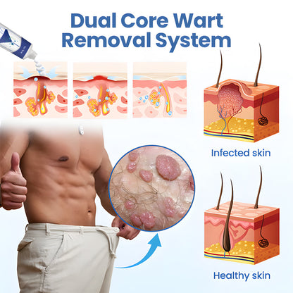 🌿 ODEIUN™ WartClear Treatment Cream — Deep Penetration, Gentle Removal of Genital Warts