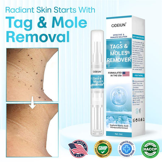 ✅ ODEIUN™ Professional Mole Removal Serum – Trusted Dermatological Formula 🩺