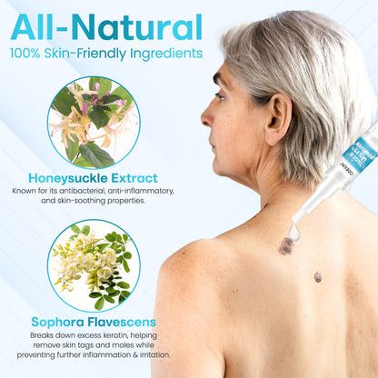 ✅ ODEIUN™ Professional Mole Removal Serum – Trusted Dermatological Formula 🩺