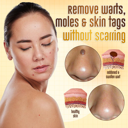 ✨ ODEIUN™ BeeDerm RX Cream – Natural Wart, Mole & Skin Tag Remover with Healing Bee Venom