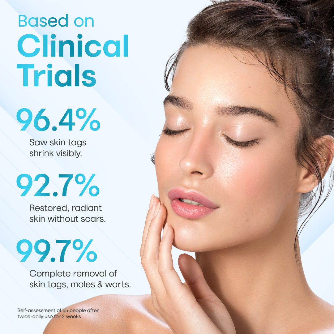 ✅ ODEIUN™ Professional Mole Removal Serum – Trusted Dermatological Formula 🩺