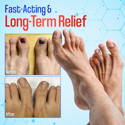 Zakdavi™ Anti-Fungal Nail Repair Patches — Say Goodbye to Nail Fungus in Days! 💅