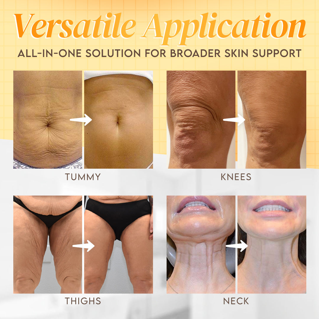 Made and Shipped from USA ✨ LBMLBM™ Bee venom Comprehensive Cream 🔥 LAST DAY 62% OFF）