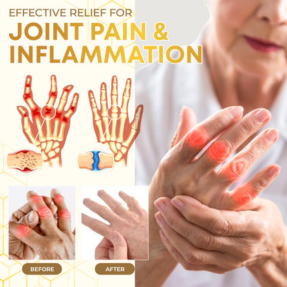 Seurico™ Bee Venom Joint Therapy Pain Relief Gel🐝🔥