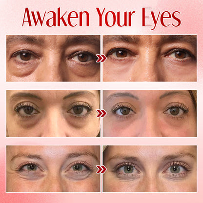 ✨ Seurico™ Instant Eye Bag Eraser: Visibly Lift & Smooth in Seconds