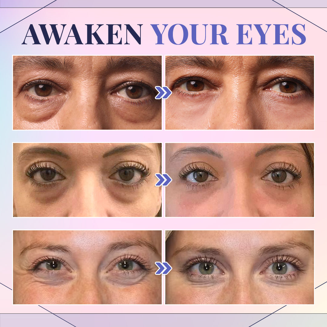 Seurico™ Advanced Eye Cream with Complete Collagen