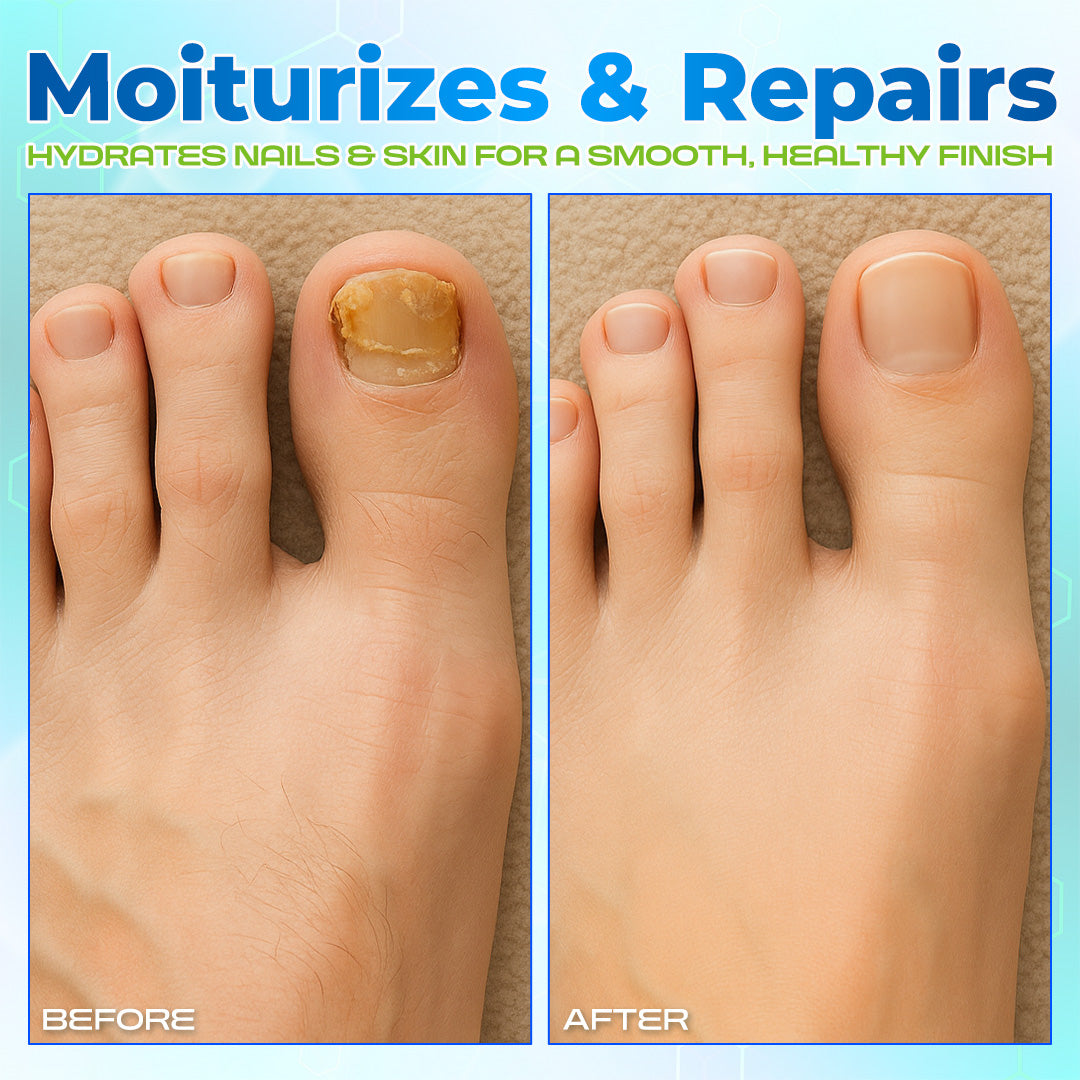 Lbmlbm® OnyxiGuard Fungal Repair Herbal Spray – 🌿 Natural Treatment for Healthy, Revitalized Skin & Nails ✨