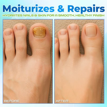 Lbmlbm® OnyxiGuard Fungal Repair Herbal Spray – 🌿 Natural Treatment for Healthy, Revitalized Skin & Nails ✨