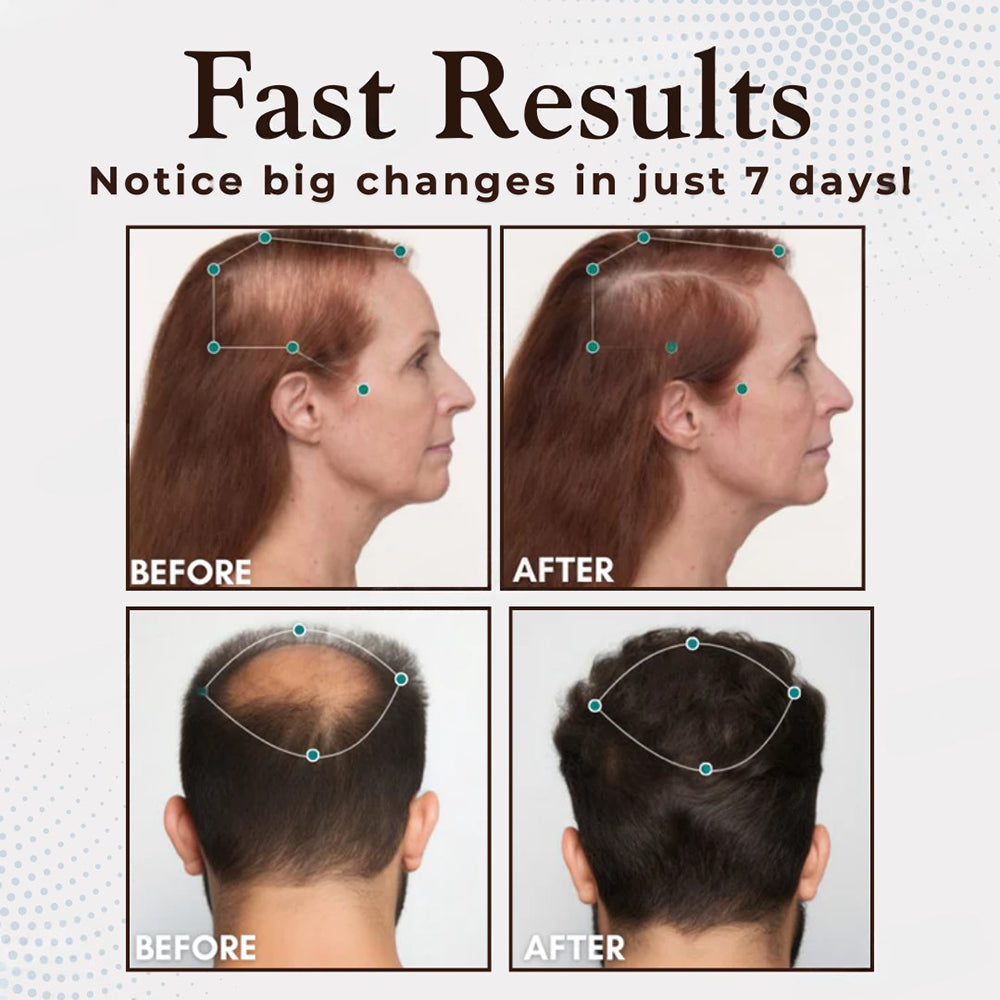 Odeiun™ Hair Renewal Capsules: Nourish for Thicker, Fuller Hair