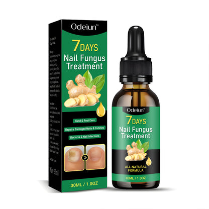 2025 New & Upgraded Negusy™ Advanced Nail Repair & Fortifying Essence