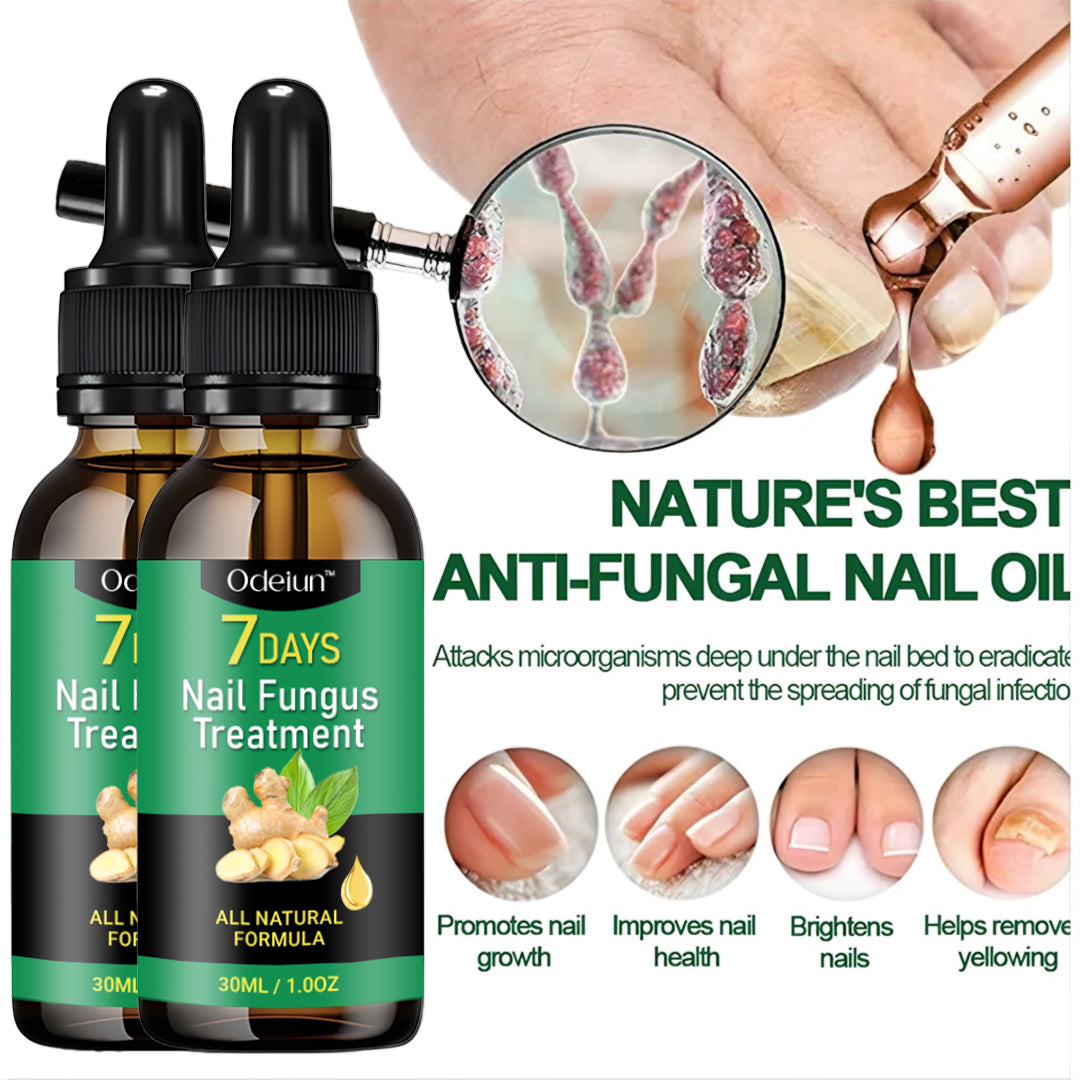 2025 New & Upgraded Negusy™ Advanced Nail Repair & Fortifying Essence