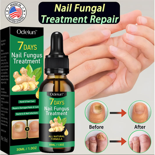 2025 New & Upgraded Negusy™ Advanced Nail Repair & Fortifying Essence