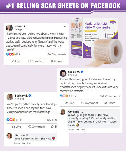 ✅Official Store |Negusy Hyaluronic Acid Nano Microneedle Repair Tape🗽🏥(Treatment of old and new scars, reduction of surgical scars, stretch marks, keloids, acne, burns, warts, dermatomes and varicose veins)