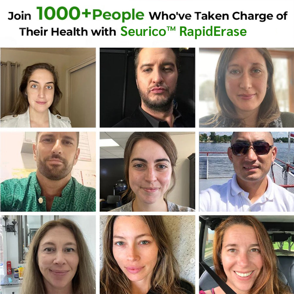 ✅ Official Store:  Seurico™ RapidErase Mole & Spot Cream