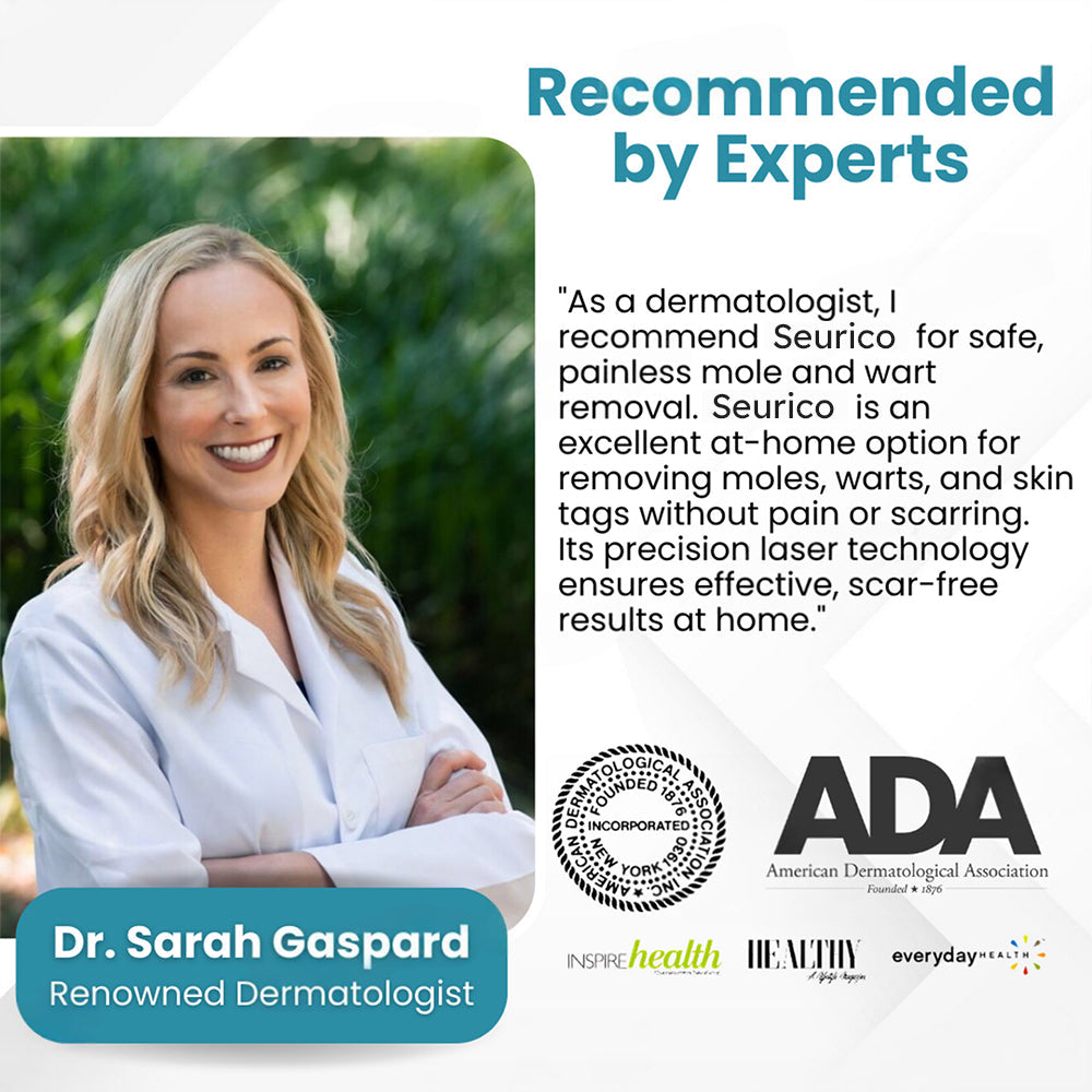 ✨Seurico™ Laser Pen - Non-invasive Mole and Wart Removal