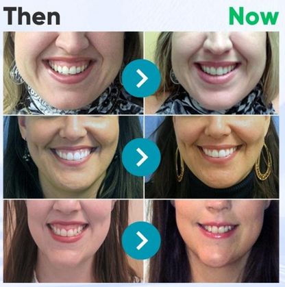 ODEIUN™ Bee Venom Dental Treatment Toothpaste