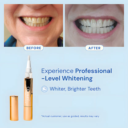 Odeiun™ Gold Teeth Whitening Serum Pen – Luxury Whitening, Dentist-Level Results