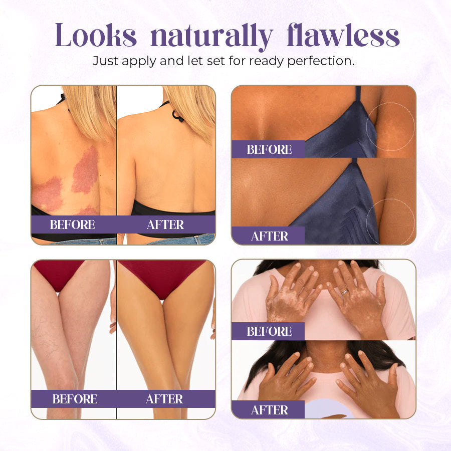 ✨ Zakdavi™ Luxe Body Coverage Perfector | Achieve Silky, Flawless Skin in Seconds 💎