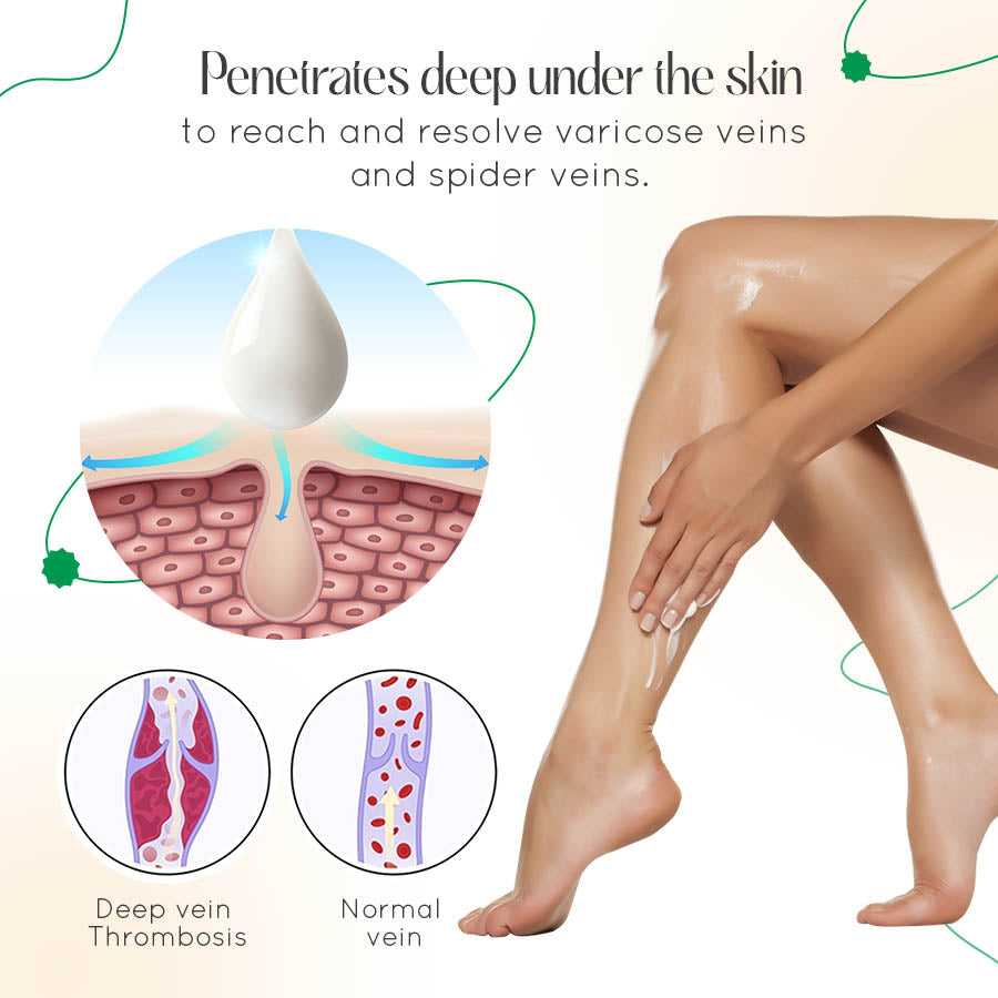 ODALIT™ Vein Therapy Cream – Natural Relief for Varicose & Spider Veins 🌿✨