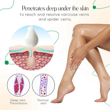 ODALIT™ Vein Therapy Cream – Natural Relief for Varicose & Spider Veins 🌿✨