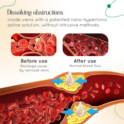 ODALIT™ Vein Therapy Cream – Natural Relief for Varicose & Spider Veins 🌿✨