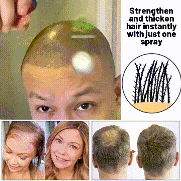 🌿 Odeiun™ Natural Hair Regrowth Spray – Naturally regrow fuller hair and restore your confidence