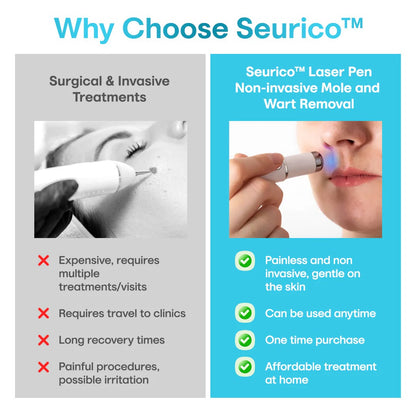 ✨Seurico™ Laser Pen - Non-invasive Mole and Wart Removal.