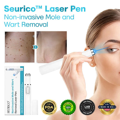 ✨Seurico™ Laser Pen - Non-invasive Mole and Wart Removal.